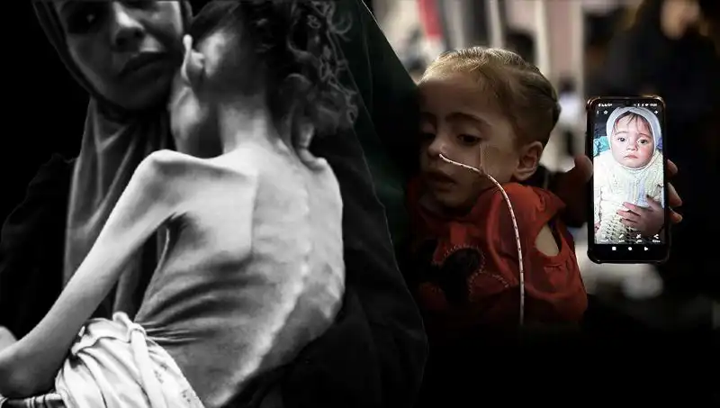 Küçük Meryem’in Hayat Mücadelesi: 25 Kilodan 10 Kiloya Düşüşü Neden?