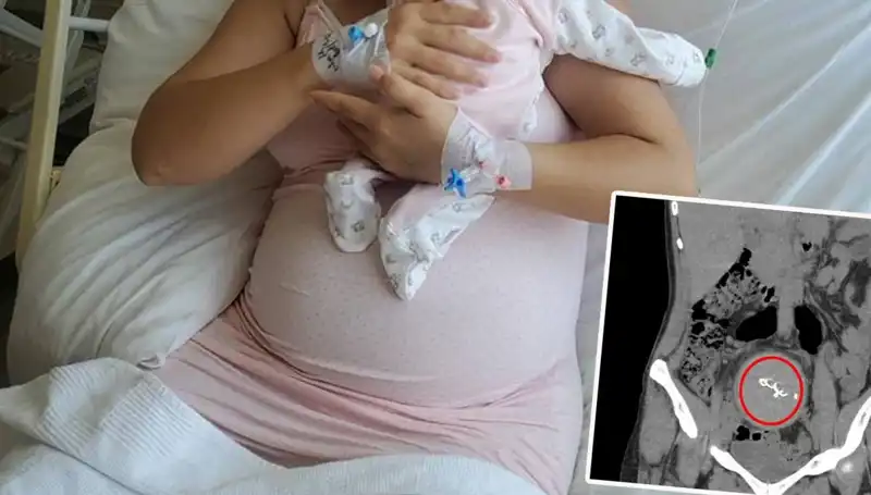 Unutulan Bebek: Doğumda Gazlı Bez İhmalinin Şok Edici Sonucu